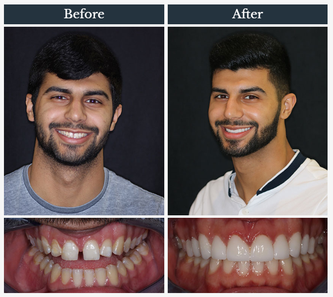 Harriman Family Dental | 96 NY-17M, Harriman, NY 10926, USA | Phone: (845) 783-6466