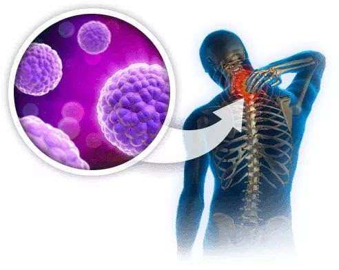 Orlando Stem Cells / Clinica del Dolor y Artritis | 7806 Lake Underhill Rd suite 106, Orlando, FL 32822, USA | Phone: (407) 985-5915