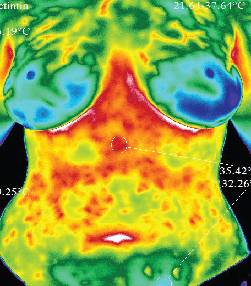 West Coast Thermography | 522 Jamacha Road, @Inner Fit Wellness 2nd Floor, El Cajon, CA 92019, USA | Phone: (619) 647-4374