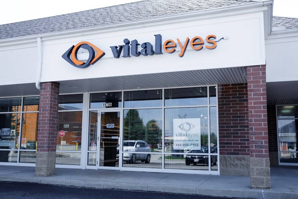 VitalEyes | 19796 W 130th St, Strongsville, OH 44136, USA | Phone: (440) 846-3937