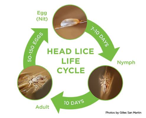 Lice Clinics of America - Chandler | 3303 S Lindsay Rd #109, Gilbert, AZ 85297, USA | Phone: (602) 309-5468