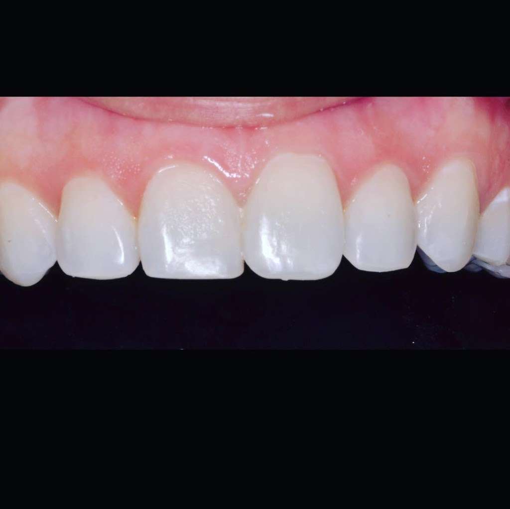 Cornerstone Dentistry | 736 Hwy 6 #102, Sugar Land, TX 77478, USA | Phone: (281) 240-2400