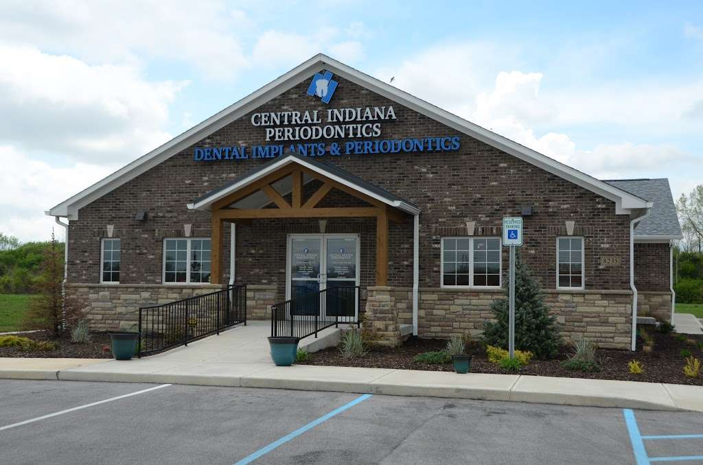 Central Indiana Periodontics PC | 8235 Country Village Dr, Indianapolis, IN 46214, USA | Phone: (317) 299-4731
