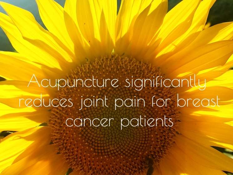 London Acupuncture Room | Rustin Room, 8 Hop Gardens, London WC2N 4EH, UK | Phone: 07769 660173