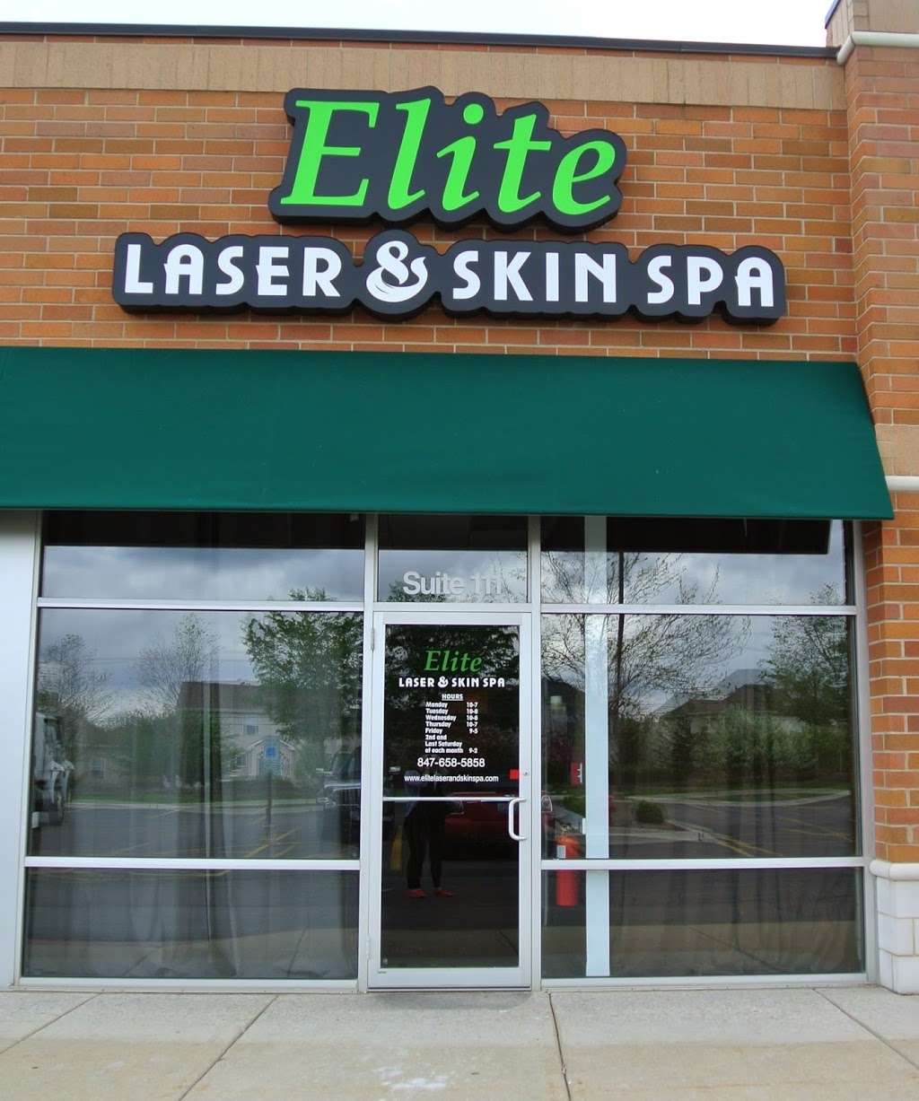 Elite Laser and Skin Spa | 4581 Princeton Ln #111, Lake in the Hills, IL 60156, USA | Phone: (847) 658-5858