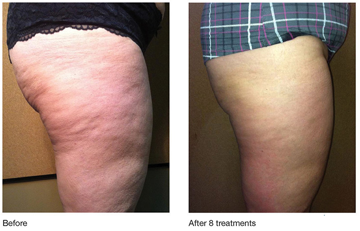 Soza Clinic | 401 W President George Bush Hwy #110, Richardson, TX 75080, USA | Phone: (972) 479-5189