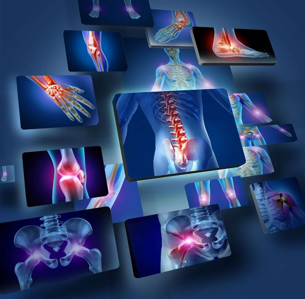 Marchand Orthopedic Acupuncture | 1140 US-287 #100, Broomfield, CO 80020 | Phone: (303) 819-9967