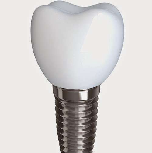 Affordable Dental Health Providers | 8207 E 3rd St Ste 102, Downey, CA 90241, USA | Phone: (562) 735-0589