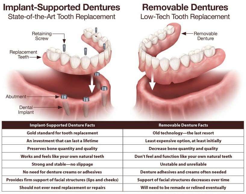 Implant Dental Arts | 1107 Nelson St Suite 201, Rockville, MD 20850, USA | Phone: (301) 424-2036