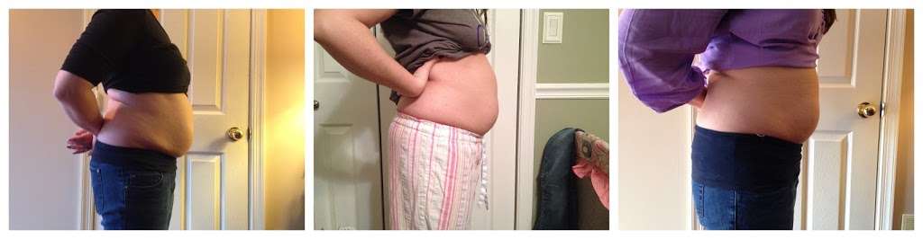 Body Applicator Wraps | 19107 Skyridge Cir, Boca Raton, FL 33498 | Phone: (888) 800-7913