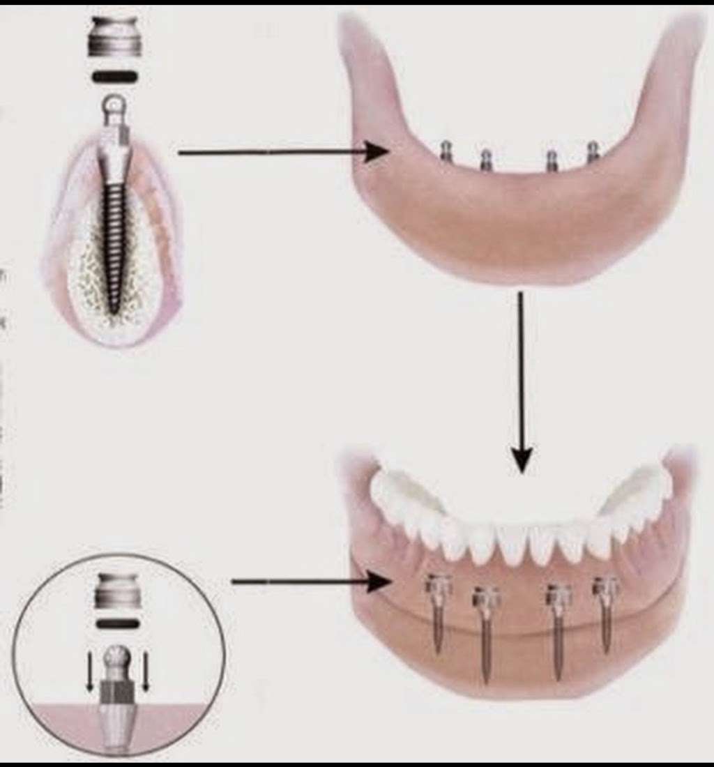 Kreative Dental Care | 120 Carter Blvd #7, Polk City, FL 33868, USA | Phone: (863) 984-0000