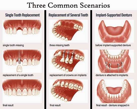 Dr. Gary Raska D.M.D - Oral Maxillofacial Surgeon - Dental Impla | 19001 US-441, Mt Dora, FL 32757, USA | Phone: (352) 383-9412