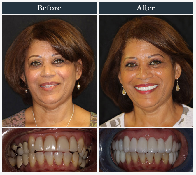 Harriman Family Dental | 96 NY-17M, Harriman, NY 10926, USA | Phone: (845) 783-6466