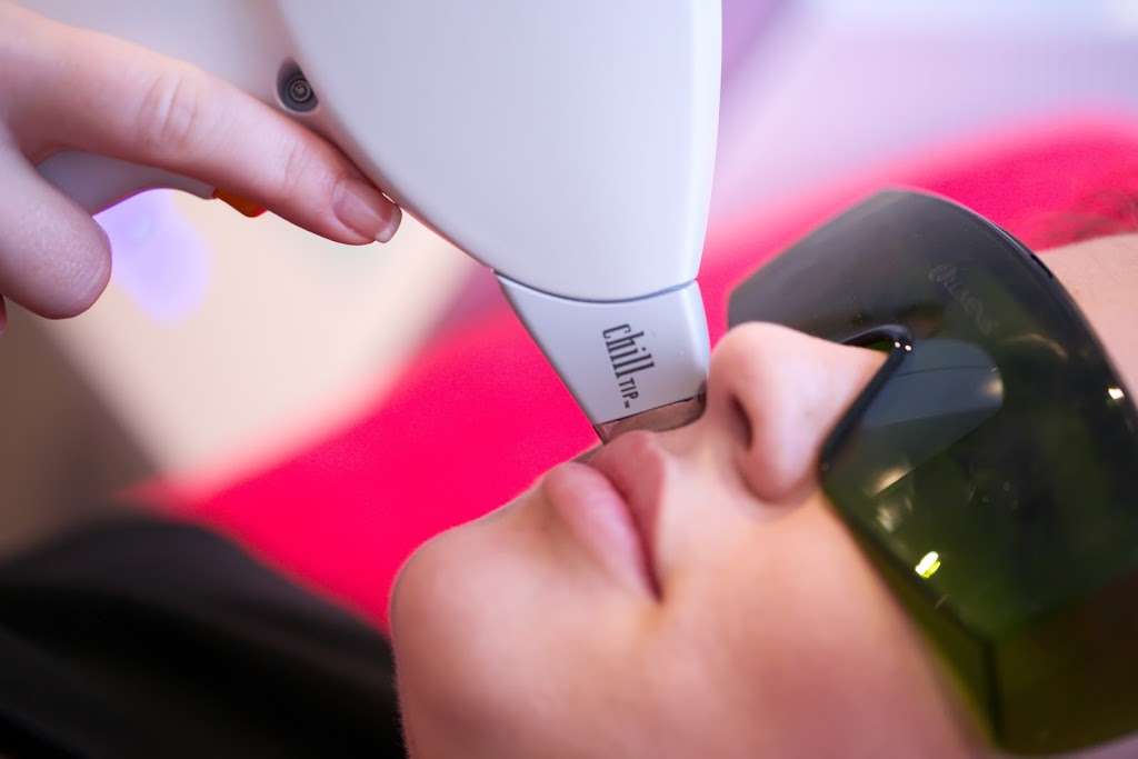 ESSEX Laser Hair removal | 4 Fleming Rd, Chafford Hundred, Grays RM16 6DD, UK | Phone: 01375 482629