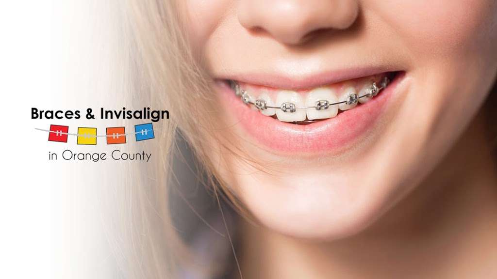Braces and Invisalign in Orange County | 1025 Westminster Mall #2057, Westminster, CA 92683, USA | Phone: (714) 862-2053