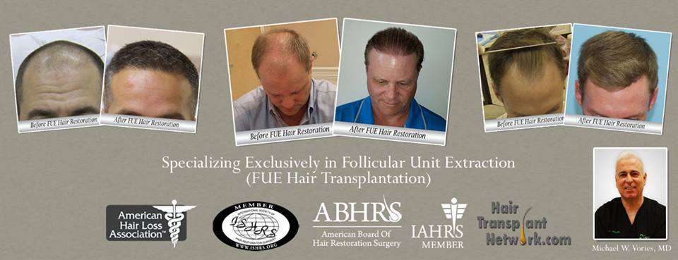 Carolina Hair Surgery: FUE Hair Transplant | 1021 Maxwell Mill Rd, Fort Mill, SC 29708, USA | Phone: (803) 217-3065