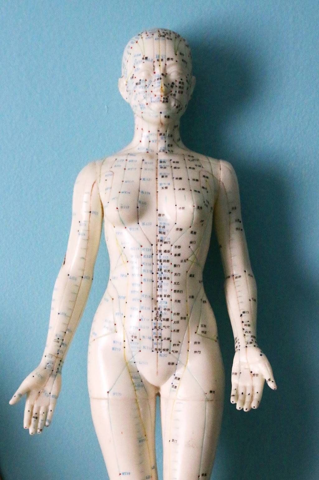 Berkeley Community Acupuncture | 2880 Sacramento St, Berkeley, CA 94702, USA | Phone: (510) 704-0593