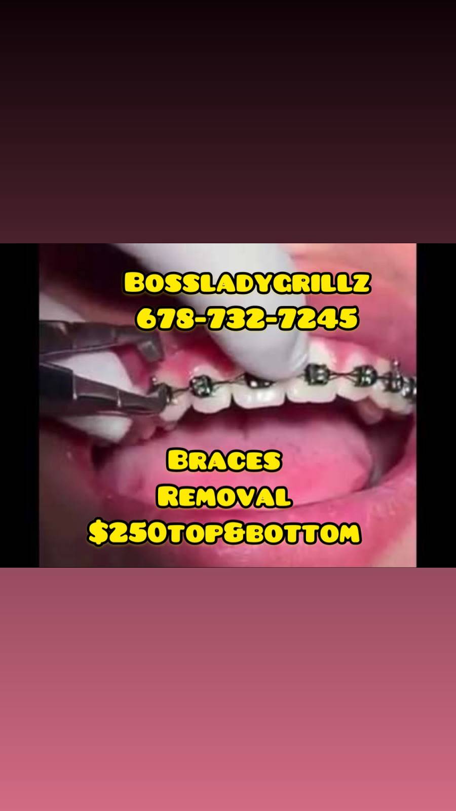 Bossladygrillz Gold Teeth Shopz | 7017 Mableton Pkwy suite d, Mableton, GA 30126, USA | Phone: (678) 732-7245