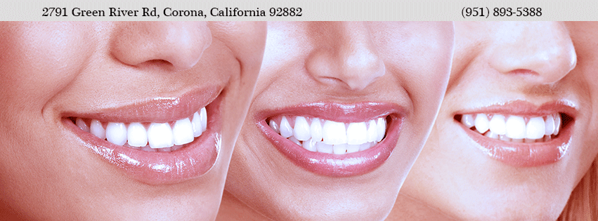 Blash Dentistry | 2791 Green River Rd #104, Corona, CA 92882, USA | Phone: (951) 893-5388