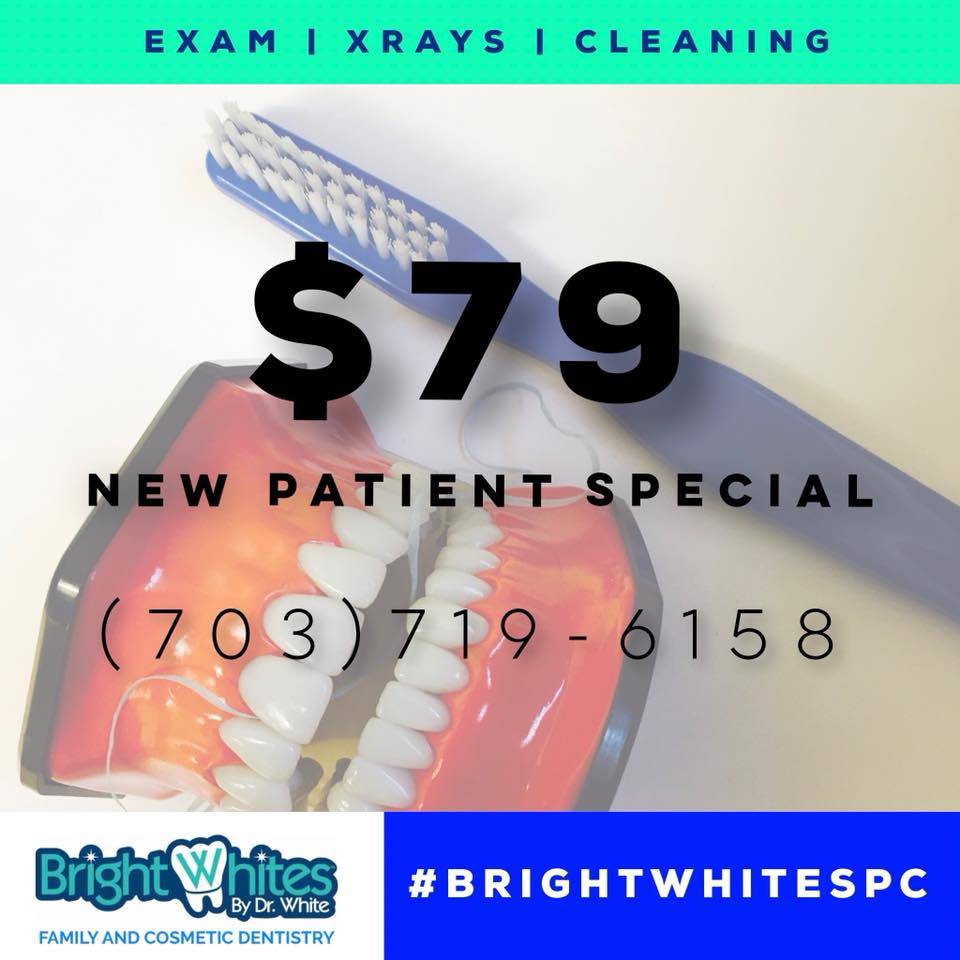 BrightWhites PC | 6214 Old Franconia Rd Suite A, Alexandria, VA 22310, United States | Phone: (703) 719-6158