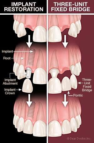 Holly Dental Associates | 8010 S Holly St, Littleton, CO 80122 | Phone: (303) 694-6400