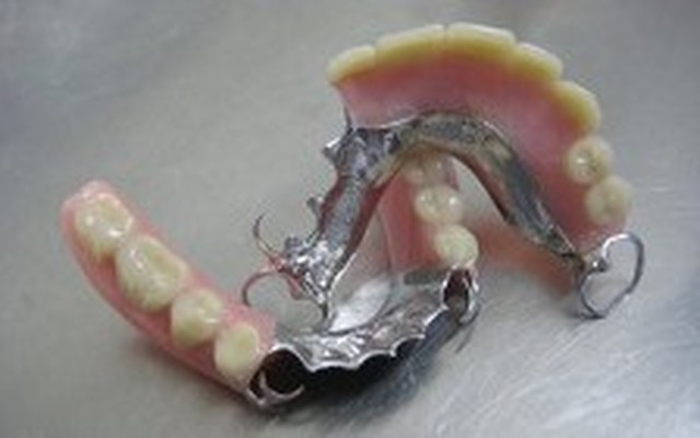 Dental Ceramics | 12 Braydon Rd, London N16 6QB, UK | Phone: 020 8802 9904