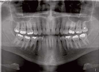 Sodium Dental X-ray Sensor Repair | 1100 N Hartley St Suite 300, York, PA 17404, USA | Phone: (800) 821-8962