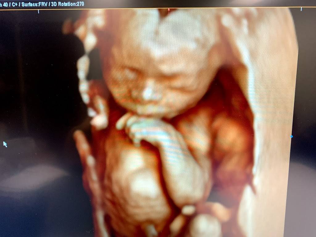 Blooming Baby 3D/4D/HD Ultrasound Studio | 4600 Greenville Ave #185, Dallas, TX 75206, USA | Phone: (214) 696-2229