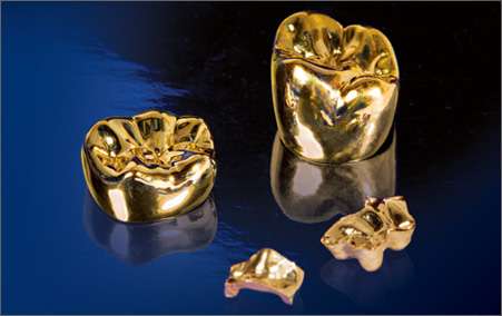 Texas Gold and Silver Buyers | 3435 Thousand Oaks #107, San Antonio, TX 78247, USA | Phone: (210) 441-2177