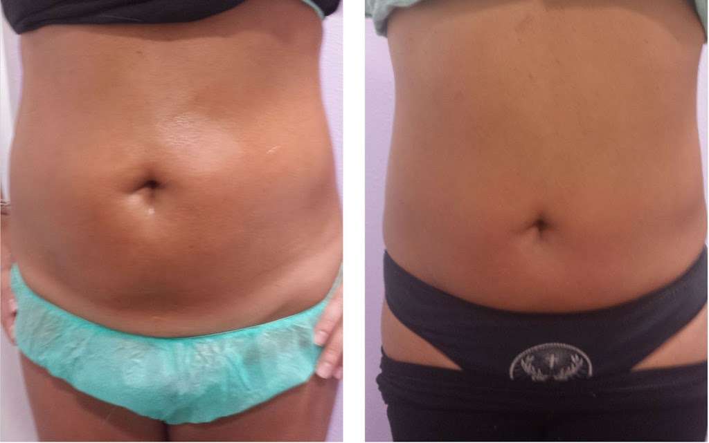 Slim Contour By Claudia LLC | 10335 Orangewood Blvd c, Orlando, FL 32821 | Phone: (407) 925-1854