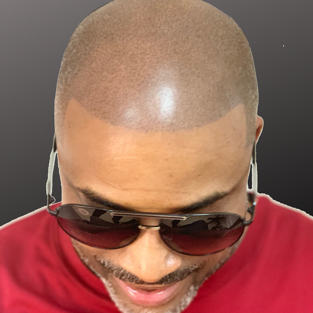 Scalp Micropigmentation • Hair Tattoo Salon | 211 TX-121 Suite #120-A, Lewisville, TX 75067, USA | Phone: (972) 839-1999