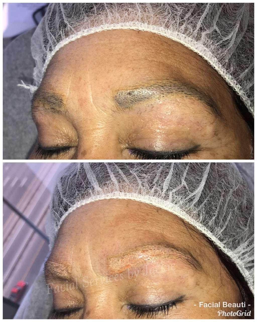 Facial Services by Jackie | 11717 Bauman Rd A, Houston, TX 77076, USA | Phone: (713) 459-9729