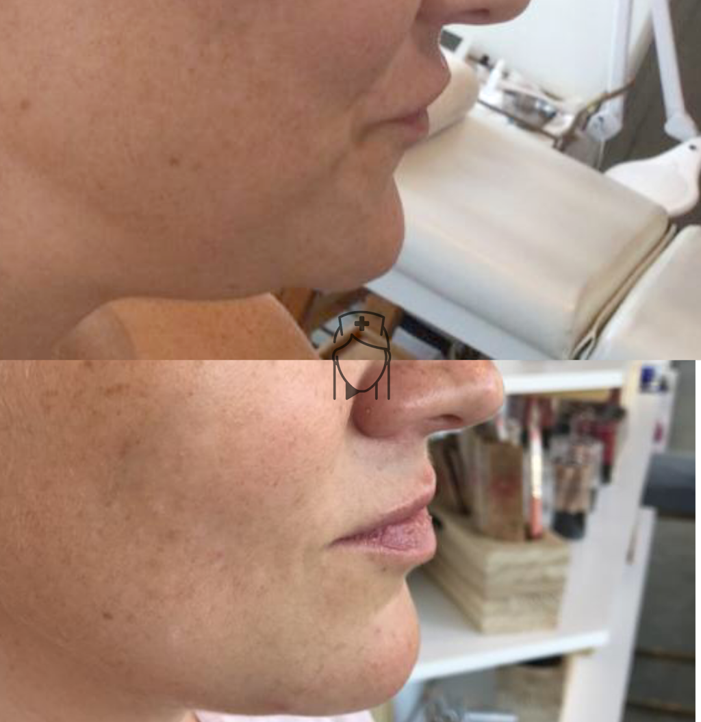 Esthetics by Rachel at Alchemy Face Bar Highlands | 4343 W 44th Ave, Denver, CO 80212 | Phone: (720) 441-2101