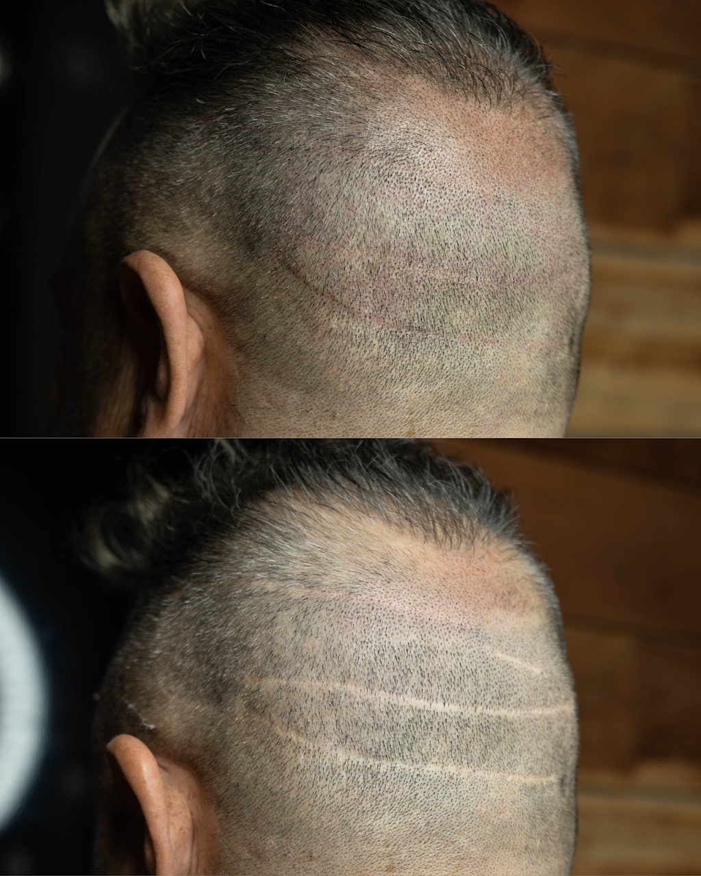 AzScalpDoctor | Scalp Micropigmentation (SMP) | 1061 N Dobson Rd #107, Mesa, AZ 85201, USA | Phone: (480) 599-0868