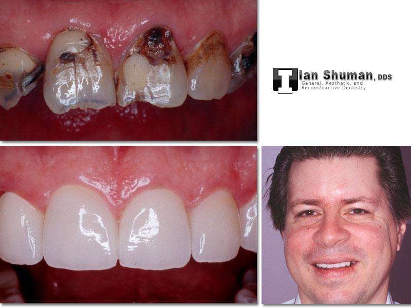 Dr. Ian Shuman, DDS | 8028 Ritchie Hwy Suite 306, Pasadena, MD 21122, USA | Phone: (410) 766-5104