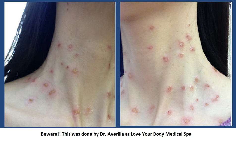 Love Your Body Medical Spa: Divina Averilla, MD | 5693 S Jones Blvd #108, Las Vegas, NV 89118 | Phone: (702) 213-5948