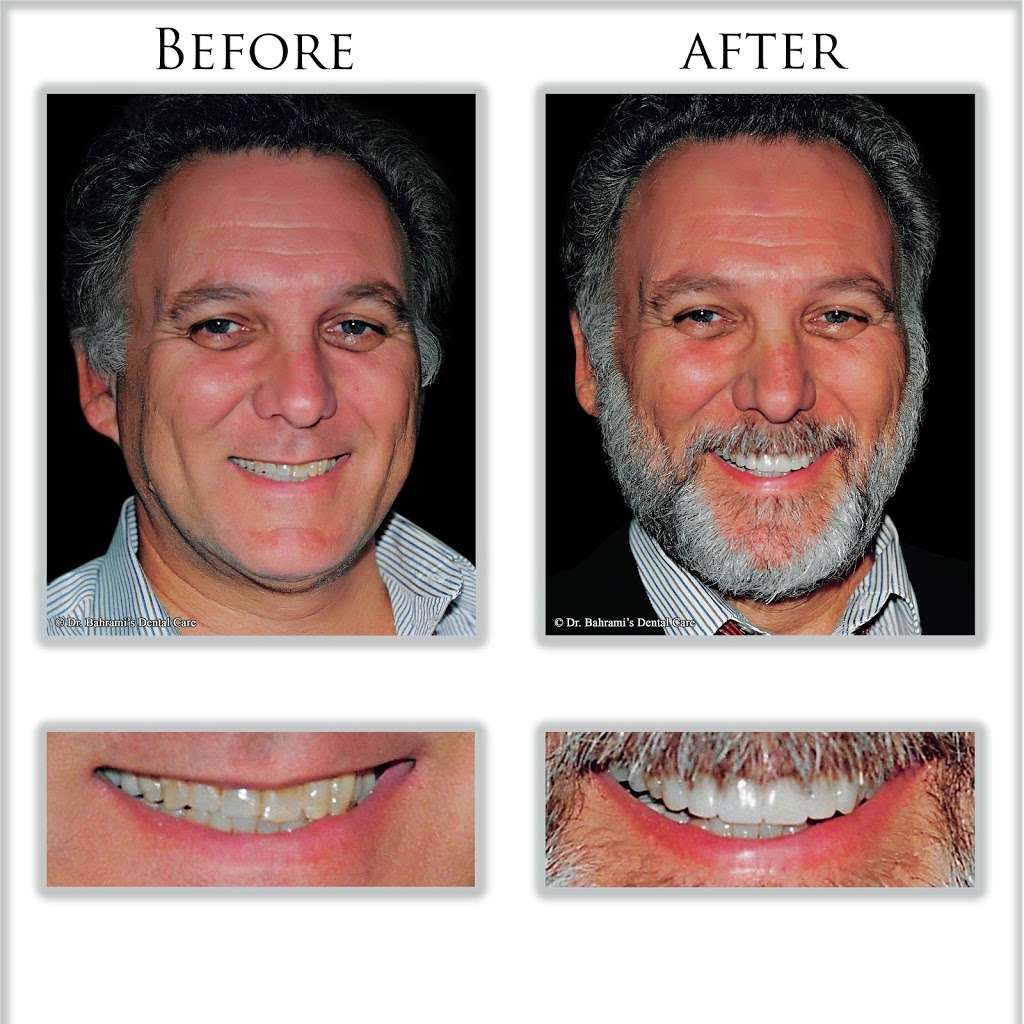 Dr. Bahramis Dental Care | 11444 W Washington Blvd, Los Angeles, CA 90066, USA | Phone: (310) 398-9800
