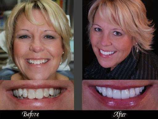 Kluth Family & Cosmetic Dentistry | 2204 S Park Ave, Alexandria, IN 46001, USA | Phone: (765) 724-7729