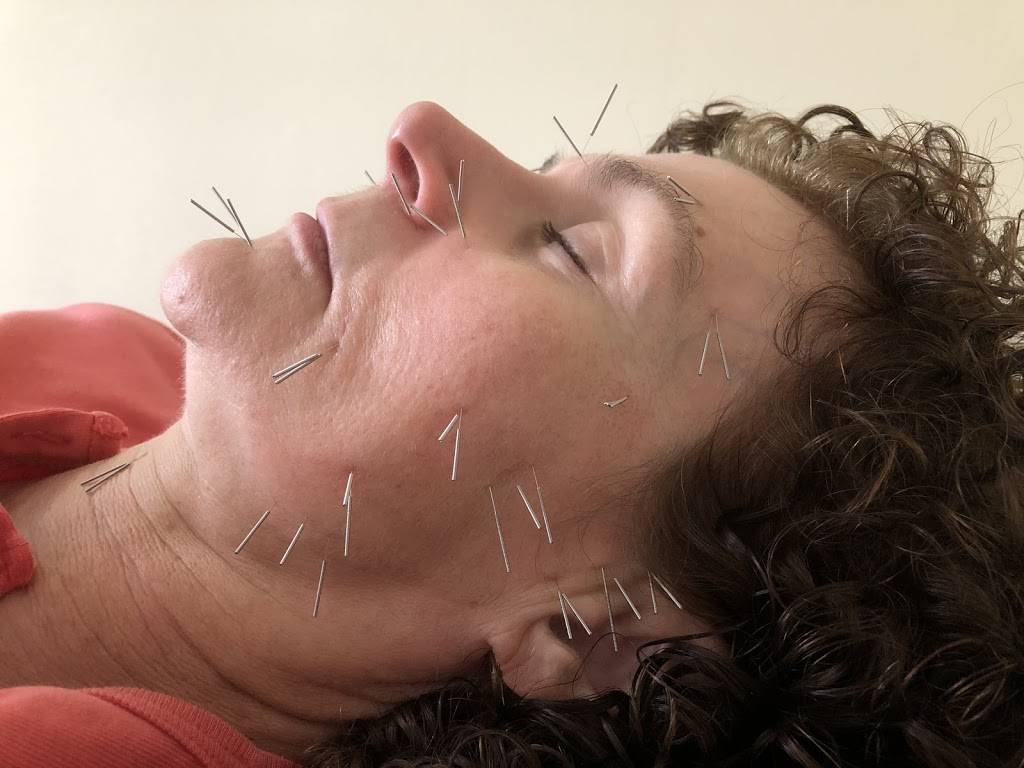 German Village Acupuncture | 374 Berkeley Rd, Columbus, OH 43205, USA | Phone: (352) 318-0154