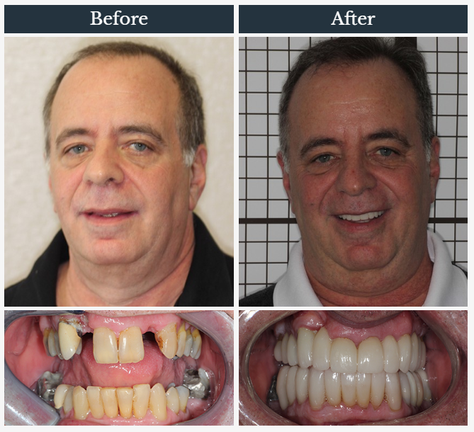 Harriman Family Dental | 96 NY-17M, Harriman, NY 10926, USA | Phone: (845) 783-6466