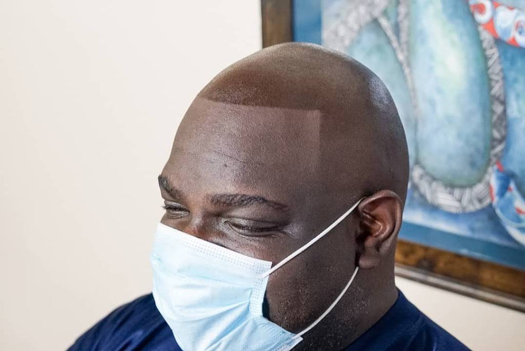 Magazine Cover Scalp Micropigmentation | 4303 S Bowen Rd suite 119, Arlington, TX 76016, USA | Phone: (817) 744-0189