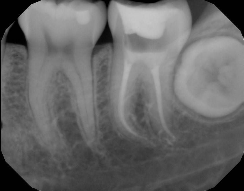 Sigma Dental Specialists | 111 S Preston Rd #50, Prosper, TX 75078, USA | Phone: (972) 432-4342