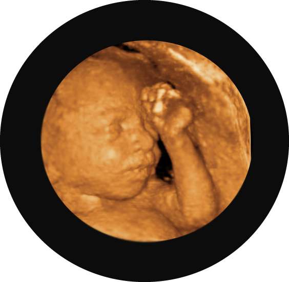 Mommy and Me 3D 4D Ultrasound | 1233 Camino del Rio S #275, San Diego, CA 92108, USA | Phone: (619) 684-5045