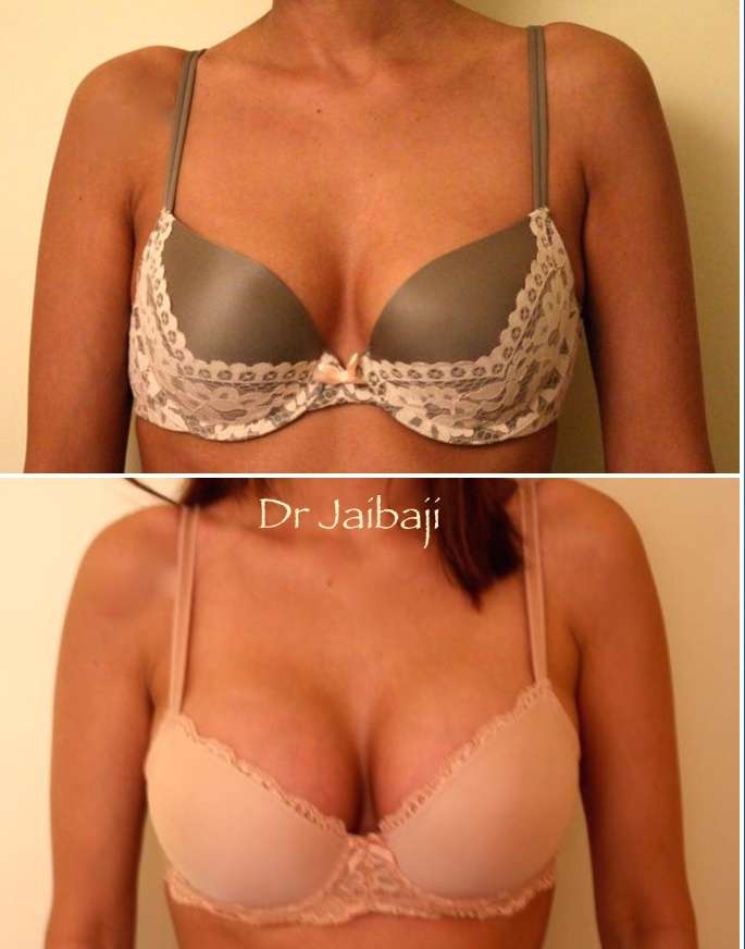 Jaibaji Plastic Surgery | 1001 B Ave Suite 108, Coronado, CA 92118, USA | Phone: (619) 435-1736