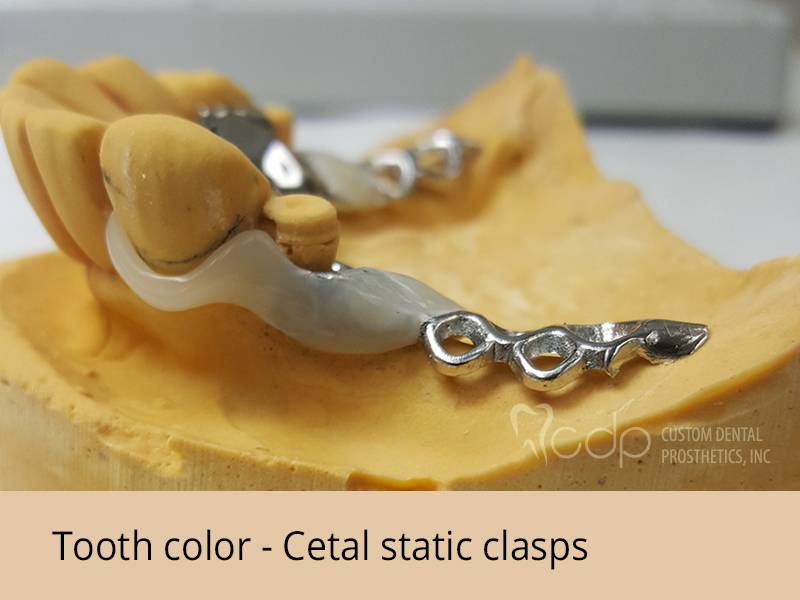 Custom Dental Prosthetics | 19155 SE McLoughlin Blvd #105, Gladstone, OR 97027, USA | Phone: (800) 595-3495