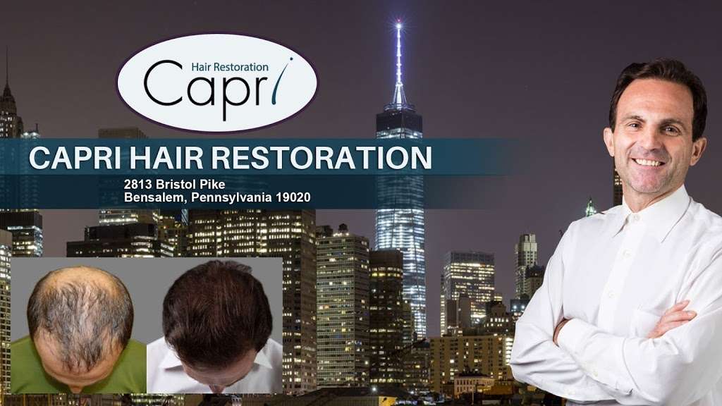 Capri Hair Restoration | 2813 Bristol Pike, Bensalem, PA 19020, USA | Phone: (877) 602-2774