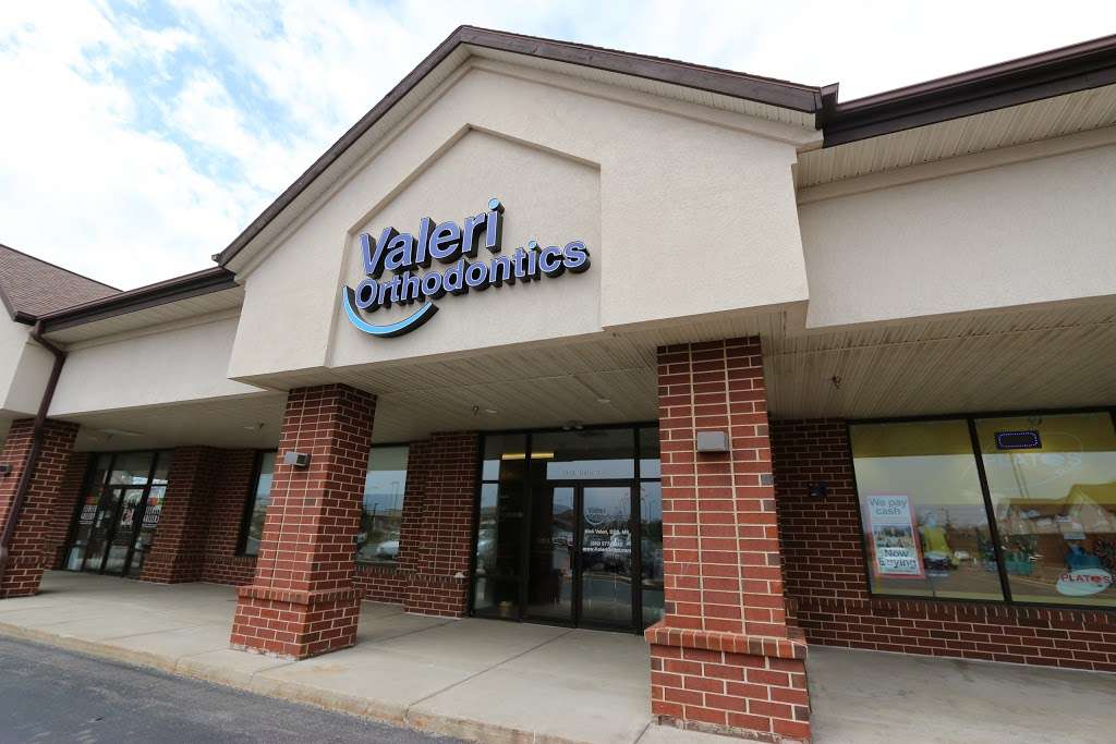 Valeri Orthodontics | 9020 76th St B, Pleasant Prairie, WI 53158, USA | Phone: (262) 577-5242