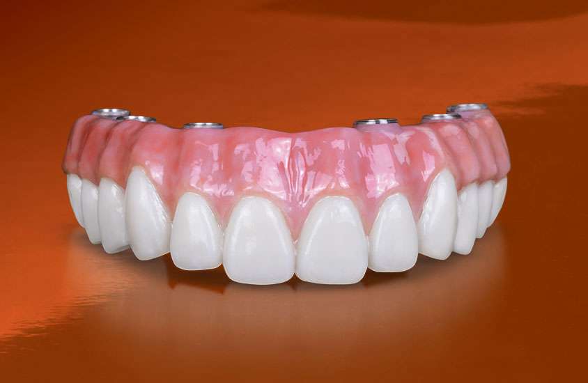Raider Dentistry | 888 US-6, Mahopac, NY 10541, USA | Phone: (845) 208-2226
