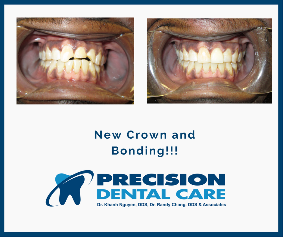 Precision Dental Care | 5745 W Belmont Ave, Chicago, IL 60634, USA | Phone: (773) 622-2642