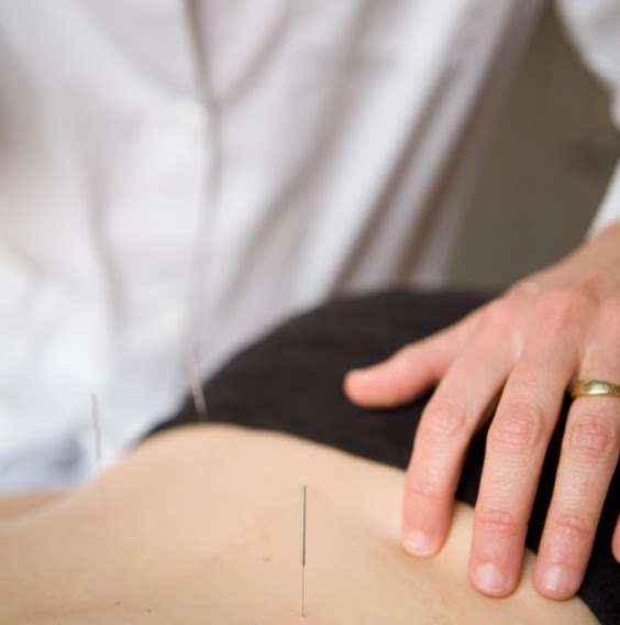 Health Source Acupuncture | 401 New Rd #211, Linwood, NJ 08221 | Phone: (609) 248-6922